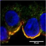 Imunofluorscenční detekce mutovaného mucinu-1 v tubulárních buňkách ledvin