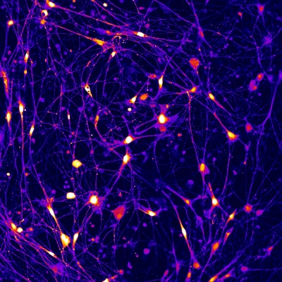 Mikroskopický obrázek neuronů pěstovaných v laboratoři.
