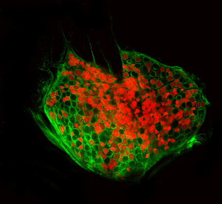 Mikroskopický obrázek shluku nociceptorů (červeně) - neuronů, které přenášejí bolest.